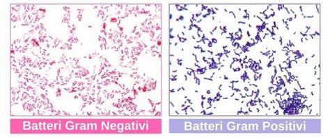 colorazione  gram identificare batteri gram positivi