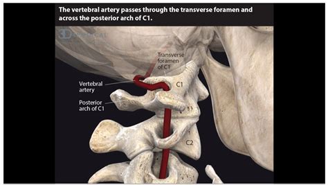 Get Anatomy C2 Cervical Vertebrae Images