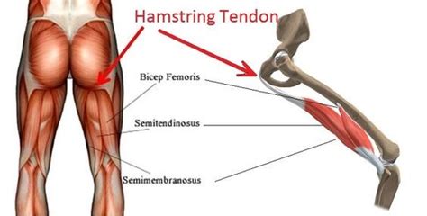 Proximal Hamstring Tendinopathy Physiotherapy Manly