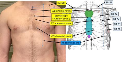 Proper Electrocardiogram Ecgekg Lead Placement Ecgedu