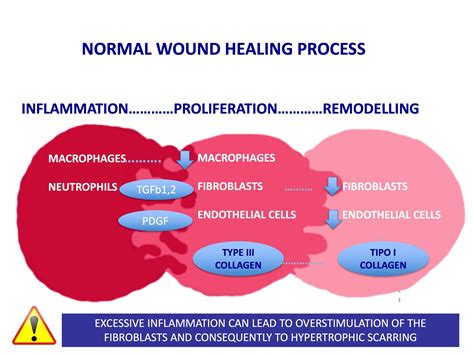 Wound Healing Process Elena Conde Montero