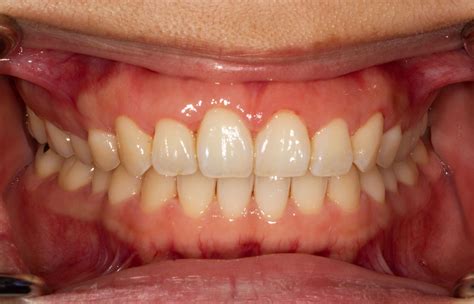 periodontal gum disease treatment in maidstone kent tie