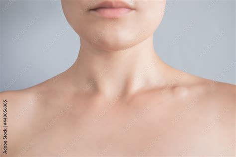 Swollen Supraclavicular Node Lump On The Clavicle Fluid Filled Lump