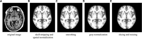 Frontiers Early Detection Of Alzheimers Disease Using Magnetic