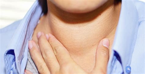 Goiter Overview Causes And Symptoms Rxsaver By Retailmenot