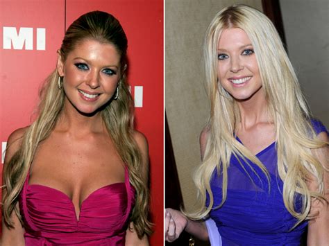 Celebrities Who Had Their Breast Implants Removed Becomegorgeous Com