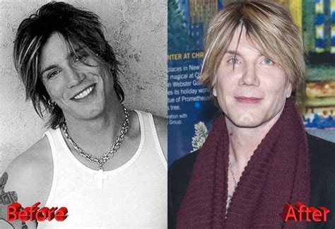 Goo Goo Dolls Singer Plastic Surgery Before And After