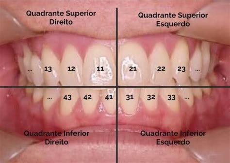 Como Aprender A Numerologia Dos Dentes Assistente De Dentista Numeração Dos Dentes