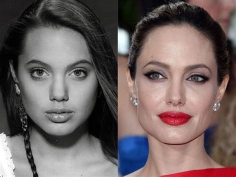 Angelina Jolie Before And After Plastic Surgery 10 Celebrity Plastic Surgery Online