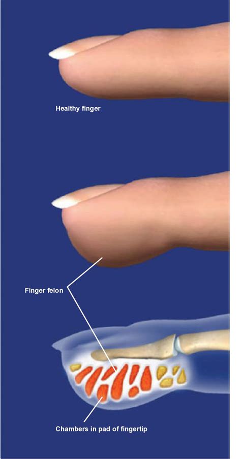 Hand And Wrist Anatomy