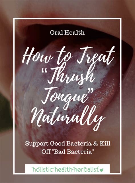 How To Treat Thrush Tongue Naturally Holistic Health Herbalist