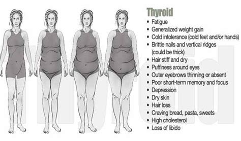 Thyroid 1 Thyroid Transformation Body Dr Berg Body Type