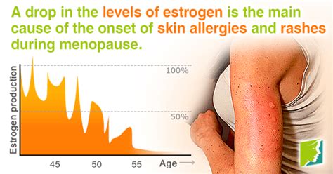 A Drop In The Levels Of Estrogen Is The Main Cause Of The Onset Of Skin