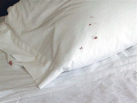 How Do You Know If Your Have Bed Bugs 7 Tell Tale Signs