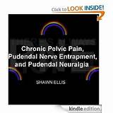 Pudendal Nerve Pain Management