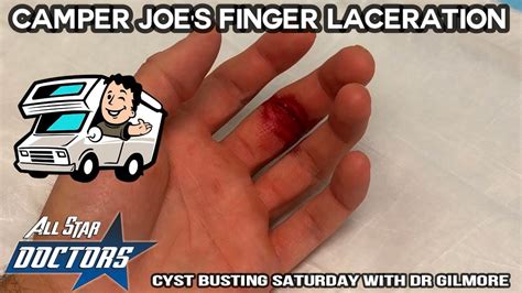 Finger Laceration Emergency Repair Youtube