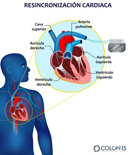Control Y Revisión De Dispositivos De Electroestimulación Cardiaca