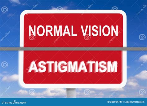 Example Normal Vision Vs Astigmatism Stock Image Image Of Normal Vision 285004749