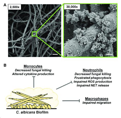 Candida Albicans Biofilm Formation And Innate Immune Response A