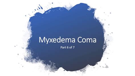 Myxedema Coma Causesymptomsdiagnosis And Treatment Youtube