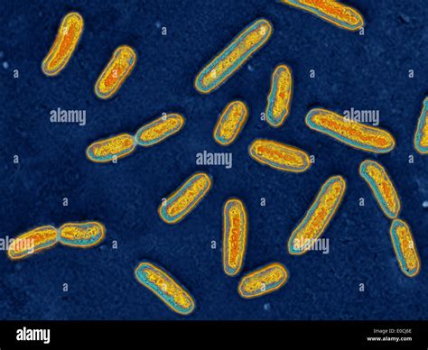 Pseudomonas Aeruginosa Stock Photo Alamy