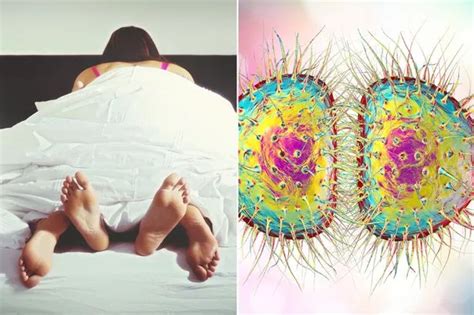 Gruesome Super Gonorrhoea Symptoms Explained As Resistant Strain Hits