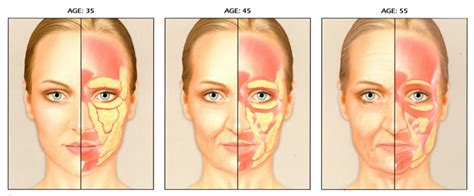 Sag And Bone What Is Really Behind An Aging Face