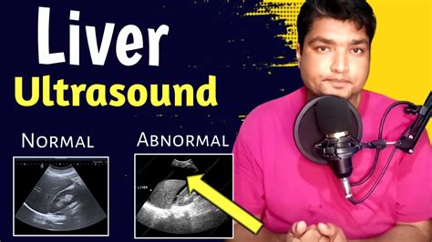 Liver Ultrasound Normal Vs Abnormal Liver Ultrasound Pathology