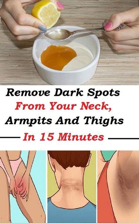 Lemon juice is naturally acidic and contains bleaching agents that will fade the dark pigment found in dark spots on the skin. Remove the dark spots between the legs, on the underarms ...