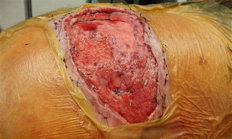 Knowing how to care for wounds at home will help your dog heal better and faster. A Novel Bandaging Method | Clinician's Brief
