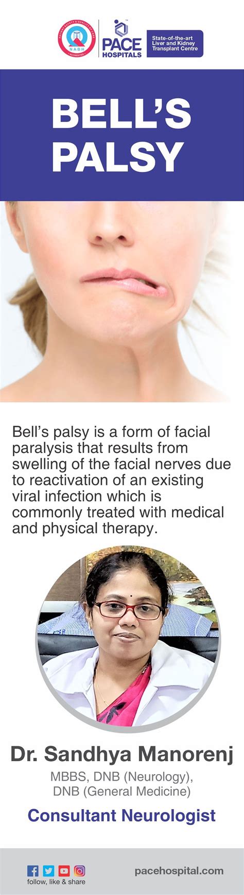 Know About Bells Palsy Facial Paralysis In 2021 Facial Nerve