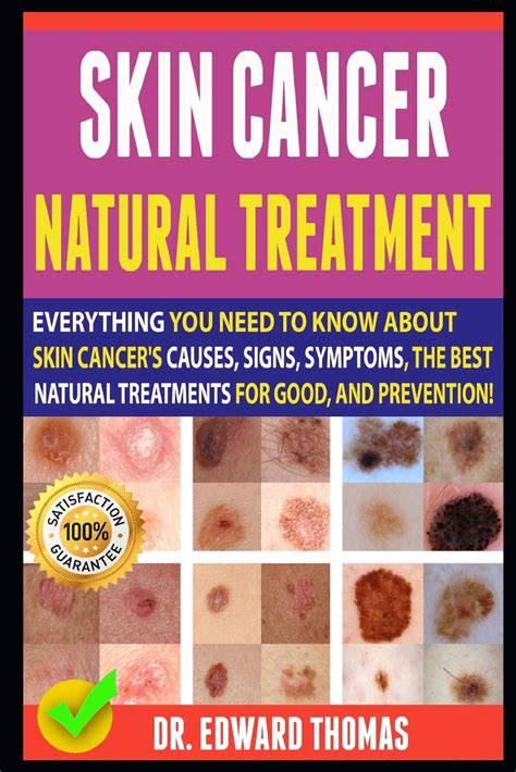 Buy Skin Cancer Natural Everything You Need To Know About Skin Cancer