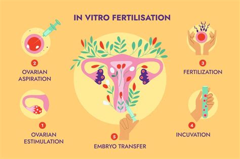 Steps In In Vitro Fertilization Ivf Yashoda Hospital