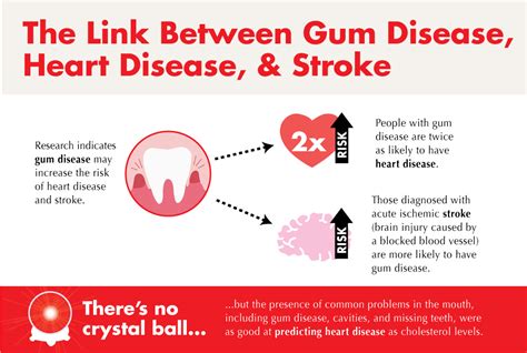 Uncovering The Connection Between Stroke And Gum Disease Millennium