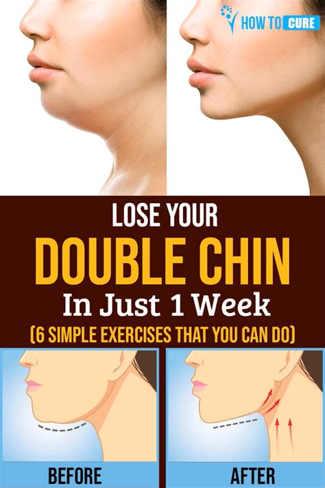 Quick Way To Get Rid Of Double Chin Anna Blog