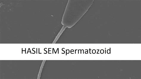 Spermatozoid Laboratorium Mineral Material Maju Sentral