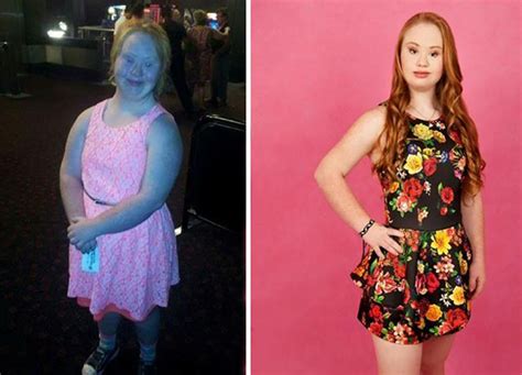Teen With Down Syndrome Is Determined To Become A Model Bored Panda