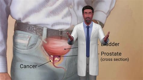 Prostate Health Mens Health Mens Health Tips Malehealthclinic