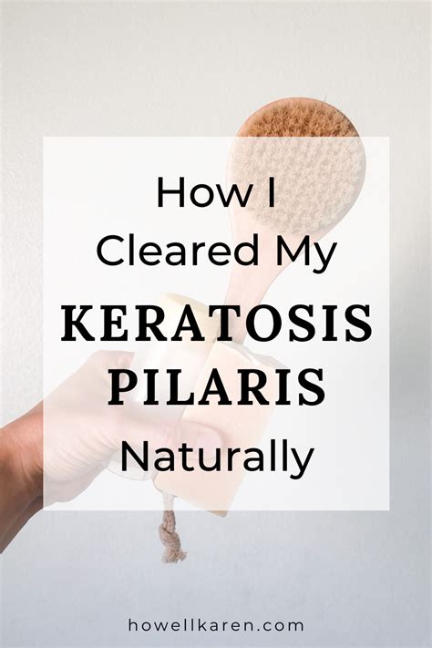 How To Get Rid Of Keratosis Pilaris With Natural Products Artofit