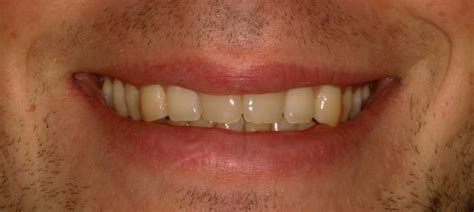 Overview The Eight Components Of A Balanced Smile Jco Online Journal Of