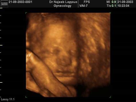 Maybe you would like to learn more about one of these? Eighth Month Pregnancy - 8 months pregnant | Dr N Layyous