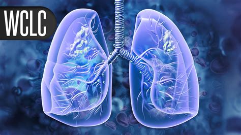 Trop2 Antibody Drug Conjugate Shows Promise In Lung Cancer Medpage Today