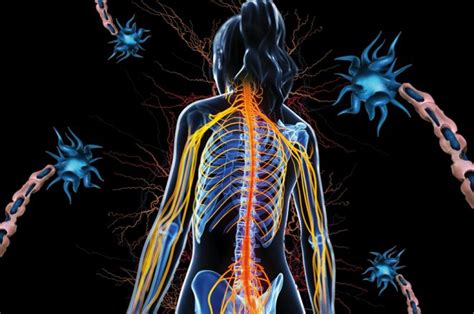 Multiple sclerosis (ms), also known as encephalomyelitis disseminata, is a demyelinating disease in which the insulating covers of nerve cells in the brain and spinal cord are damaged. La lucha contra la esclerosis múltiple | Reporte Indigo