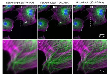 Edigest Deep Learning Takes Fluorescence Microscopy Into Super Resolution