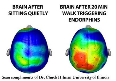 How Brain Imaging Helps Explain Social Anxiety Disorder