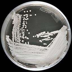 Some strains of candida auris (c. General Information about Candida auris | Fungal Diseases ...