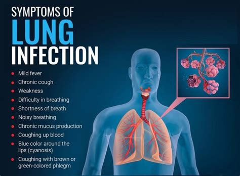 Signs And Symptoms Of Lung Infection My Health Only