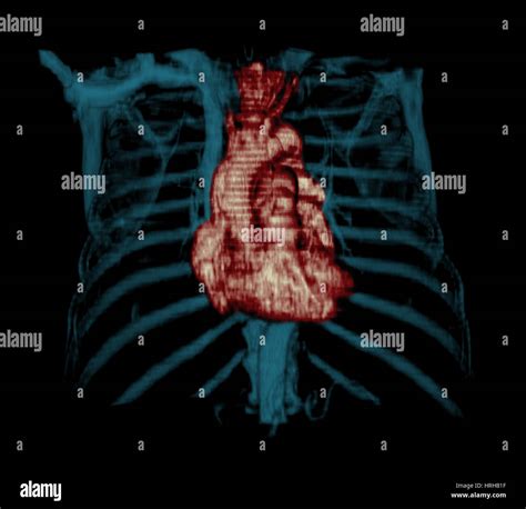 3d Ct Reconstruction Of Heart Stock Photo Alamy