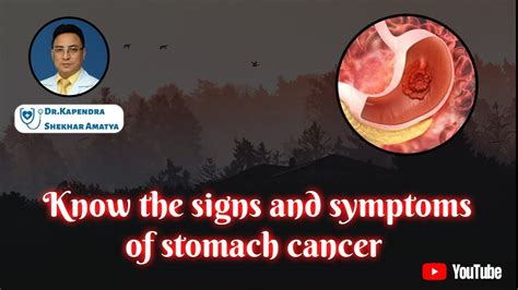 Signs And Symptoms Of Stomach Cancer पेट क्यान्सरका लक्ष्यणहरु Dr