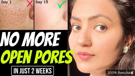 Days Skincare Challenge Get Rid Of Open Pores Naturally In Just